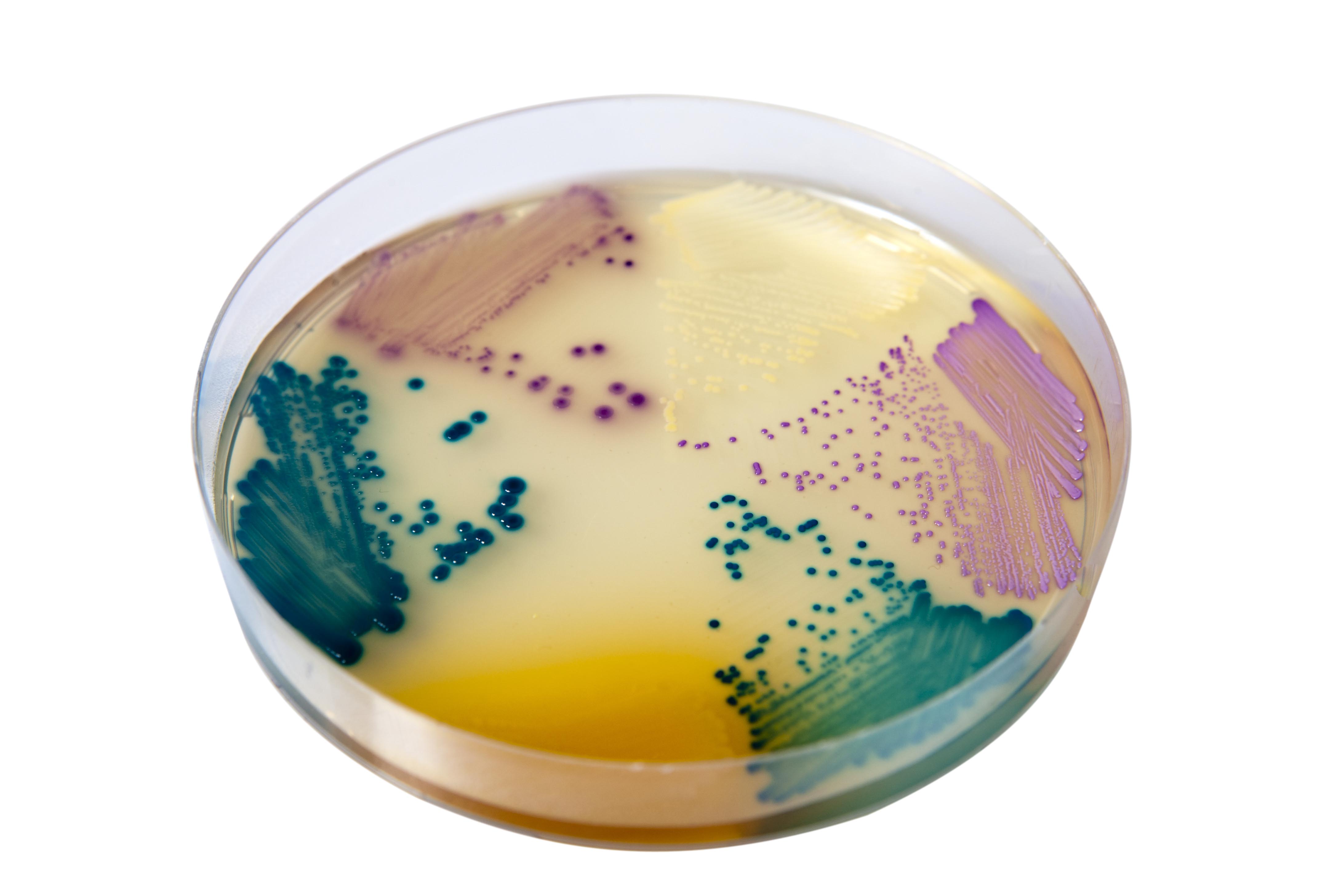 Sanimed -m TM CHROM Orientation/ Хромогенне середовище для виділення і диференціації патогенів сечових шляхів